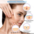 Shangyang pimple acne patches korean acne pimple master patch hydrocolloid breylee pimple patch